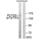 Western Blot - Anti-PLCG2 (phospho Tyr753) Antibody (A0081) - Antibodies.com