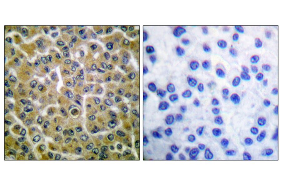Immunohistochemistry - Anti-PLCG2 (phospho Tyr753) Antibody (A0081) - Antibodies.com