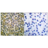 Immunohistochemistry - Anti-PLCG2 (phospho Tyr753) Antibody (A0081) - Antibodies.com