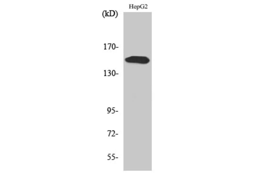 Western Blot - Anti-PLCG2 (phospho Tyr753) Antibody (A0081) - Antibodies.com