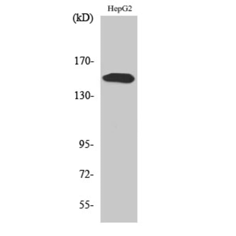 Western Blot - Anti-PLCG2 (phospho Tyr753) Antibody (A0081) - Antibodies.com