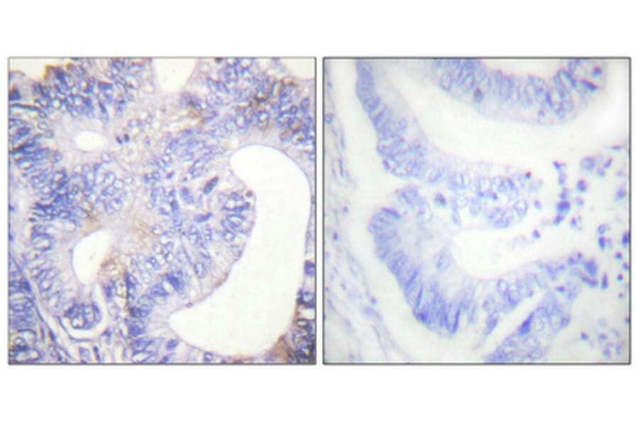 Immunohistochemistry - Anti-PLCG2 (phospho Tyr753) Antibody (A0081) - Antibodies.com