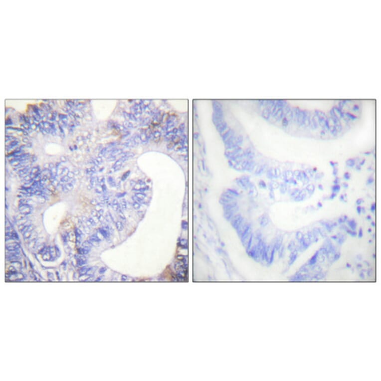 Immunohistochemistry - Anti-PLCG2 (phospho Tyr753) Antibody (A0081) - Antibodies.com