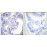 Immunohistochemistry - Anti-PLCG2 (phospho Tyr753) Antibody (A0081) - Antibodies.com