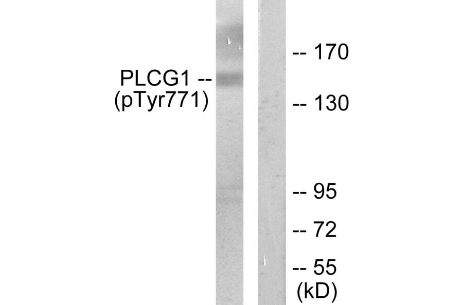 Western Blot - Anti-PLCG1 (phospho Tyr771) Antibody (A0079) - Antibodies.com