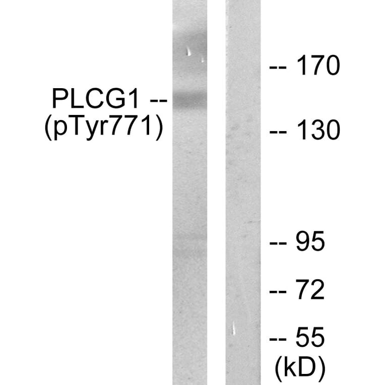 Western Blot - Anti-PLCG1 (phospho Tyr771) Antibody (A0079) - Antibodies.com
