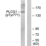 Western Blot - Anti-PLCG1 (phospho Tyr771) Antibody (A0079) - Antibodies.com
