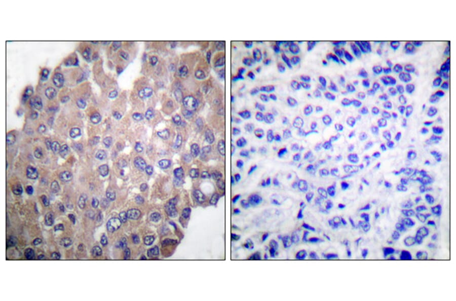 Immunohistochemistry - Anti-PLCG1 (phospho Tyr771) Antibody (A0079) - Antibodies.com