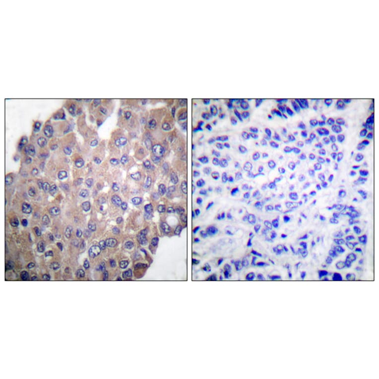 Immunohistochemistry - Anti-PLCG1 (phospho Tyr771) Antibody (A0079) - Antibodies.com