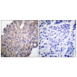 Immunohistochemistry - Anti-PLCG1 (phospho Tyr771) Antibody (A0079) - Antibodies.com