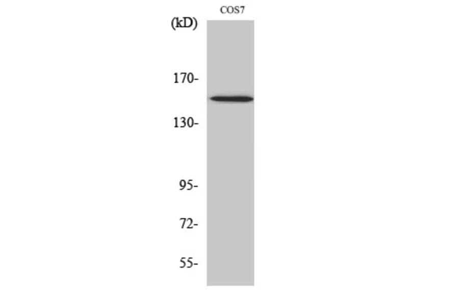 Western Blot - Anti-PLCG1 (phospho Tyr771) Antibody (A0079) - Antibodies.com