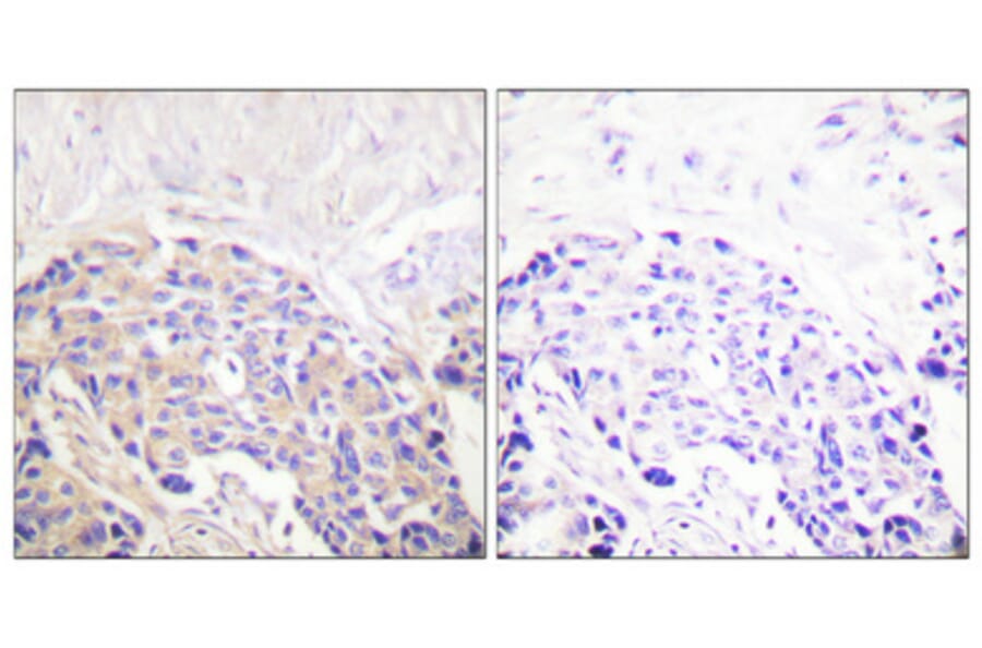 Immunohistochemistry - Anti-PLCG1 (phospho Tyr771) Antibody (A0079) - Antibodies.com