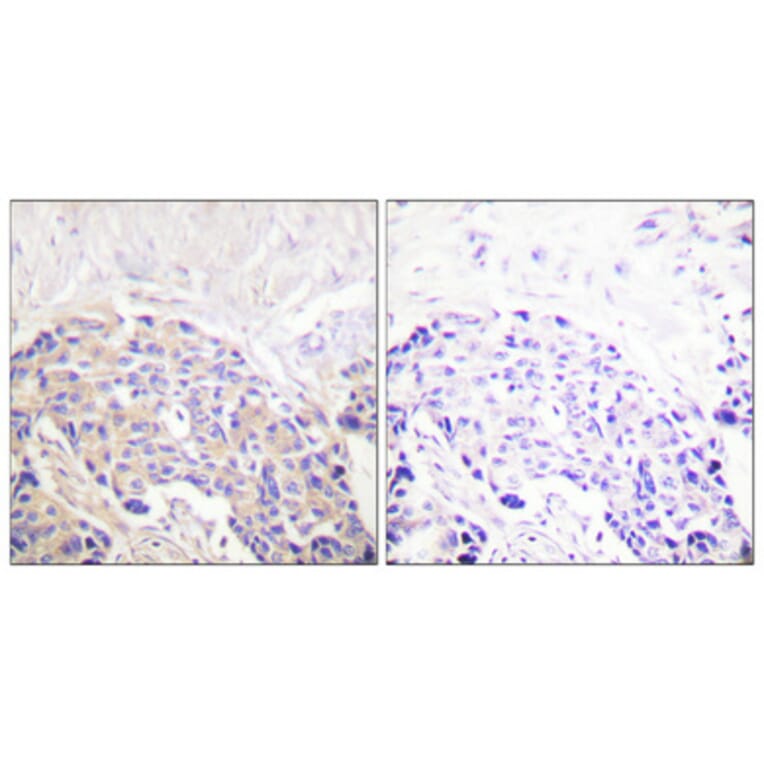 Immunohistochemistry - Anti-PLCG1 (phospho Tyr771) Antibody (A0079) - Antibodies.com