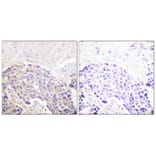 Immunohistochemistry - Anti-PLCG1 (phospho Tyr771) Antibody (A0079) - Antibodies.com