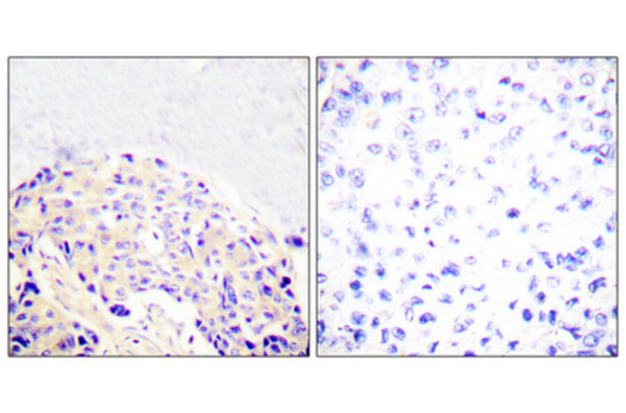 Immunohistochemistry - Anti-PLCG1 (phospho Tyr771) Antibody (A0079) - Antibodies.com