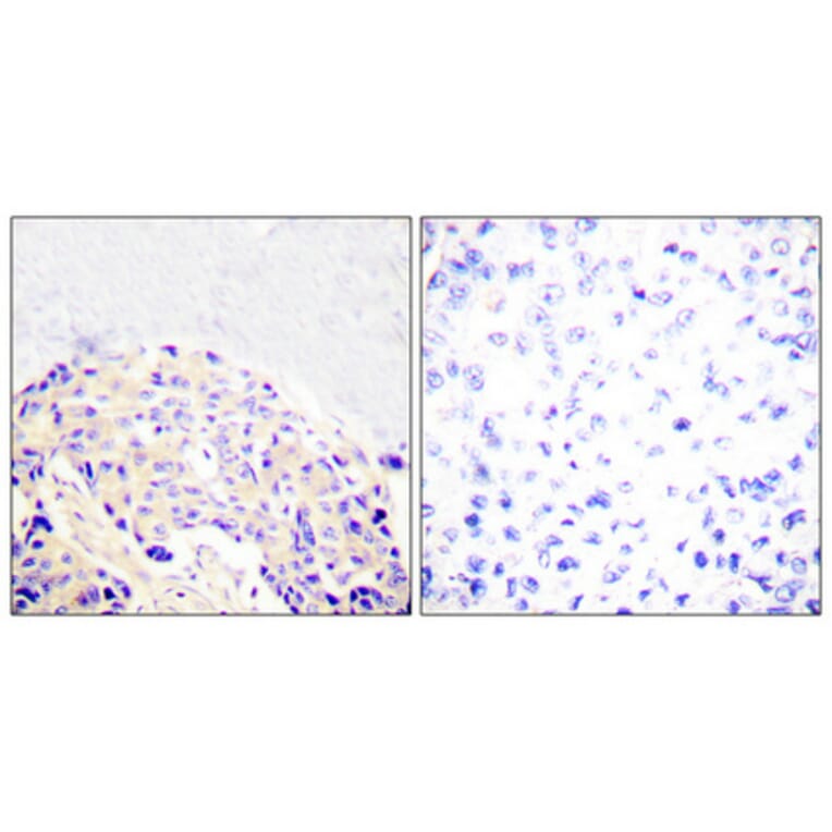 Immunohistochemistry - Anti-PLCG1 (phospho Tyr771) Antibody (A0079) - Antibodies.com