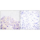 Immunohistochemistry - Anti-PLCG1 (phospho Tyr771) Antibody (A0079) - Antibodies.com