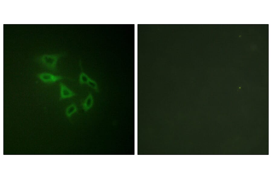Immunofluorescence - Anti-PIP5K (phospho Ser307) Antibody (A1176) - Antibodies.com