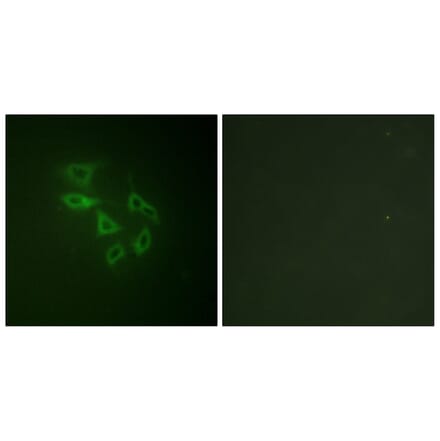 Immunofluorescence - Anti-PIP5K (phospho Ser307) Antibody (A1176) - Antibodies.com
