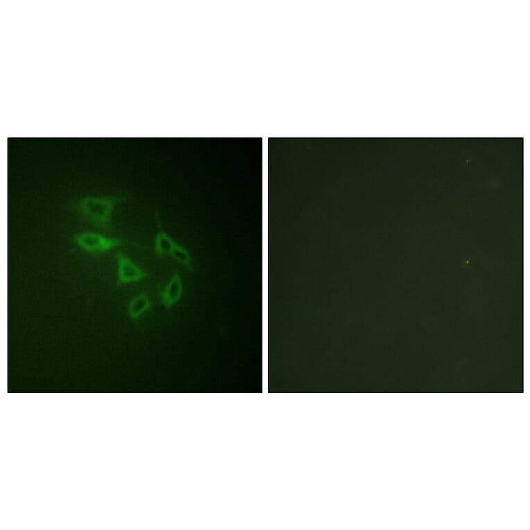 Immunofluorescence - Anti-PIP5K (phospho Ser307) Antibody (A1176) - Antibodies.com