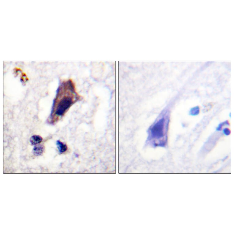 Immunohistochemistry - Anti-PIP5K (phospho Ser307) Antibody (A1176) - Antibodies.com