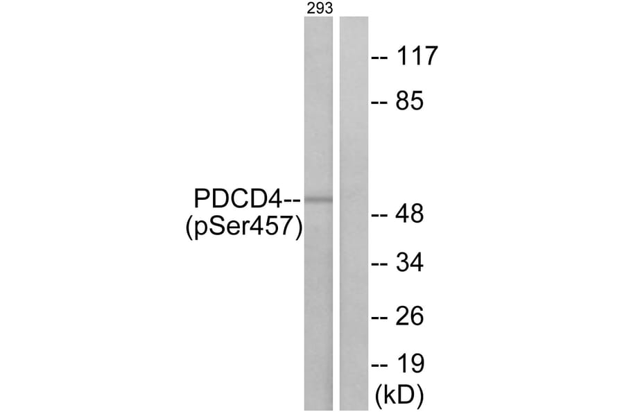 Western Blot - Anti-PDCD4 (phospho Ser457) Antibody (A1175) - Antibodies.com