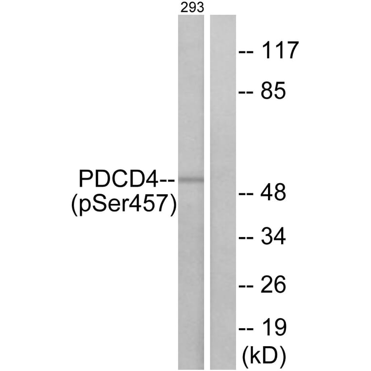 Western Blot - Anti-PDCD4 (phospho Ser457) Antibody (A1175) - Antibodies.com