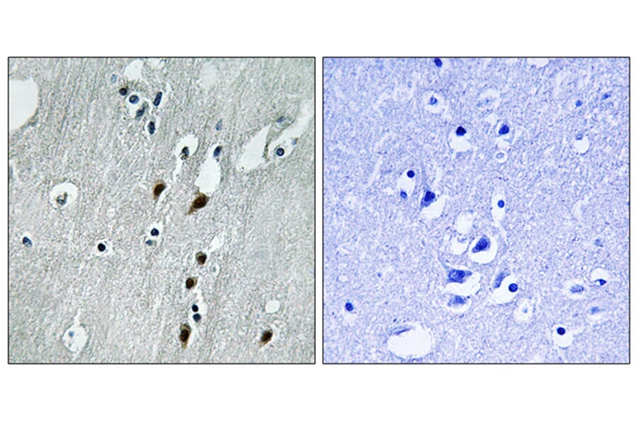 Immunohistochemistry - Anti-PDCD4 (phospho Ser457) Antibody (A1175) - Antibodies.com