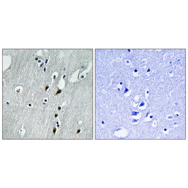 Immunohistochemistry - Anti-PDCD4 (phospho Ser457) Antibody (A1175) - Antibodies.com