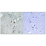 Immunohistochemistry - Anti-PDCD4 (phospho Ser457) Antibody (A1175) - Antibodies.com