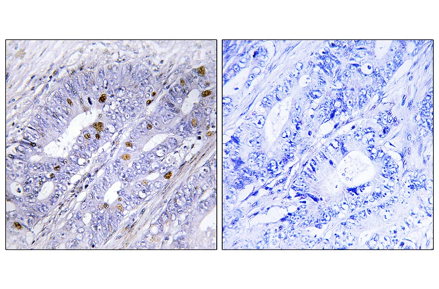 Immunohistochemistry - Anti-Nuclear Receptor NR4A1 Antibody (B1168) - Antibodies.com