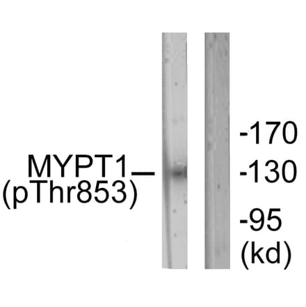 Western Blot - Anti-MYPT1 (phospho Thr853) Antibody (A0518) - Antibodies.com