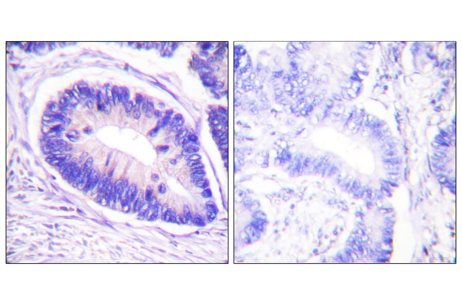 Immunohistochemistry - Anti-MYPT1 (phospho Thr853) Antibody (A0518) - Antibodies.com