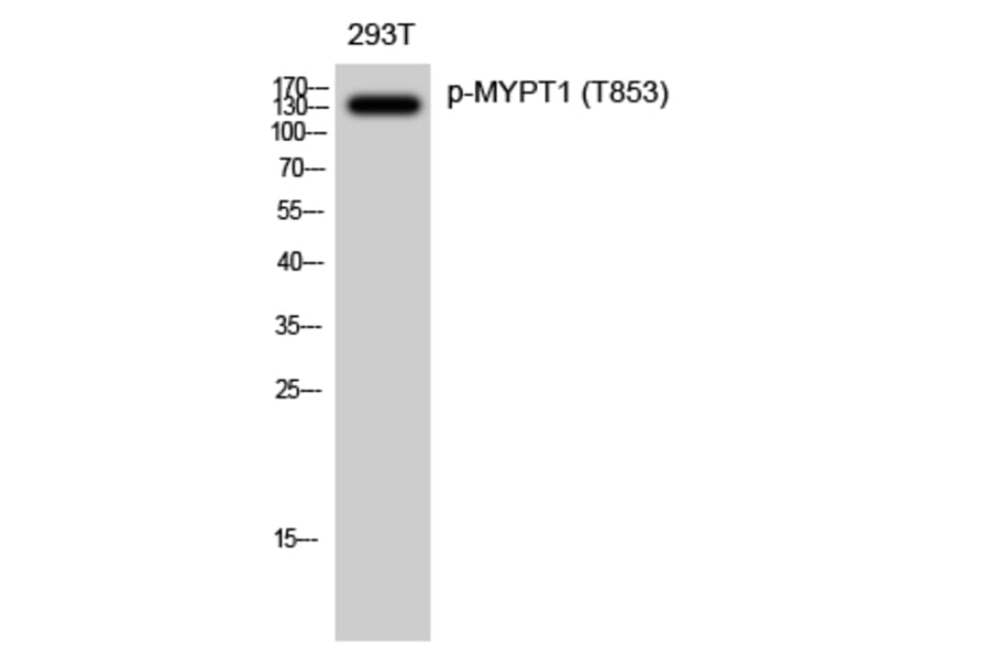 Western Blot - Anti-MYPT1 (phospho Thr853) Antibody (A0518) - Antibodies.com