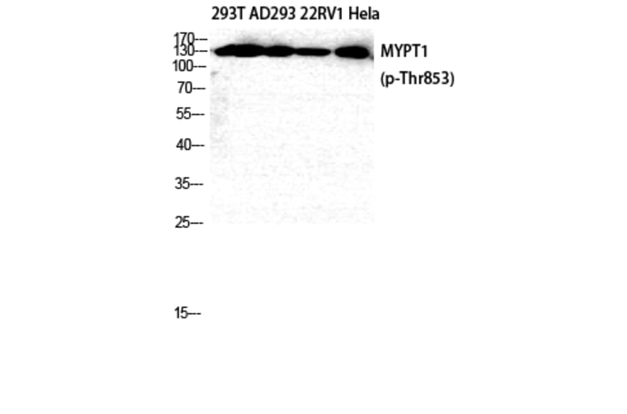 Western Blot - Anti-MYPT1 (phospho Thr853) Antibody (A0518) - Antibodies.com