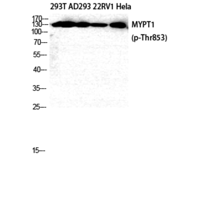 Western Blot - Anti-MYPT1 (phospho Thr853) Antibody (A0518) - Antibodies.com