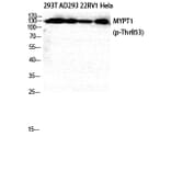 Western Blot - Anti-MYPT1 (phospho Thr853) Antibody (A0518) - Antibodies.com