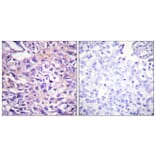 Immunohistochemistry - Anti-MYPT1 (phospho Thr696) Antibody (A0517) - Antibodies.com