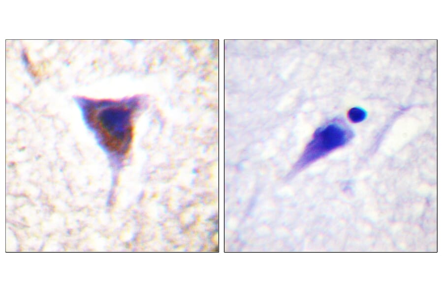 Immunohistochemistry - Anti-mTOR (phospho Ser2481) Antibody (A0688) - Antibodies.com