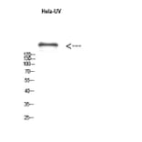 Western Blot - Anti-mTOR (phospho Ser2481) Antibody (A0688) - Antibodies.com