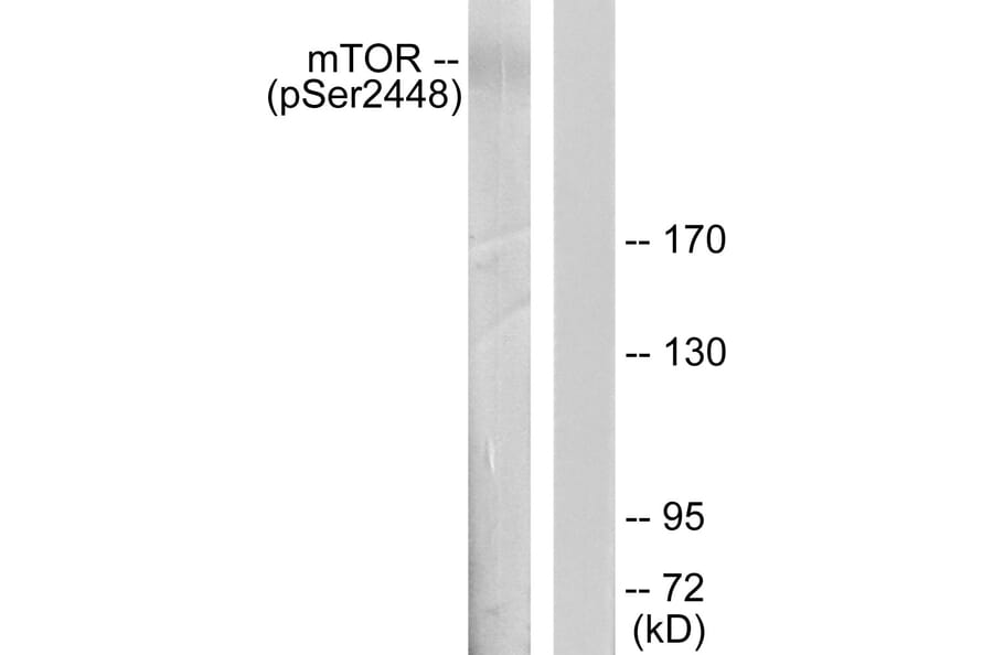 Western Blot - Anti-mTOR (phospho Ser2448) Antibody (A7156) - Antibodies.com