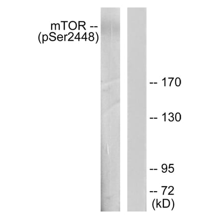 Western Blot - Anti-mTOR (phospho Ser2448) Antibody (A7156) - Antibodies.com