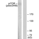 Western Blot - Anti-mTOR (phospho Ser2448) Antibody (A7156) - Antibodies.com