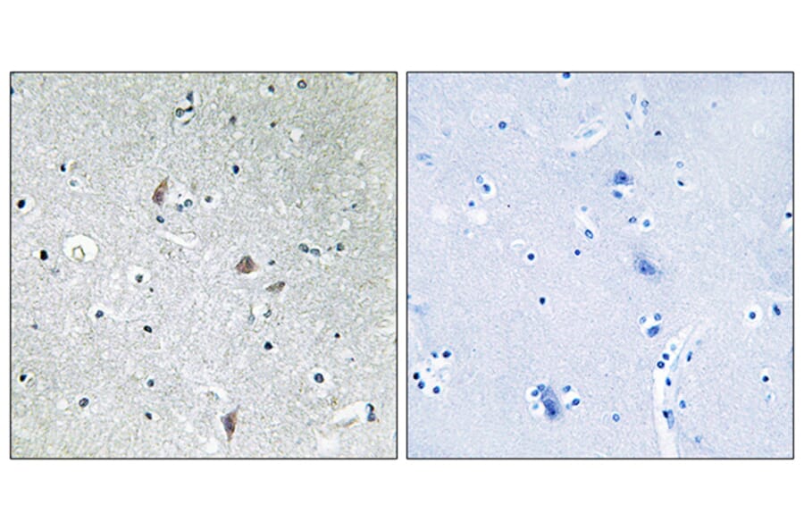 Immunohistochemistry - Anti-mTOR (phospho Ser2448) Antibody (A7156) - Antibodies.com