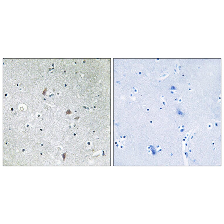 Immunohistochemistry - Anti-mTOR (phospho Ser2448) Antibody (A7156) - Antibodies.com