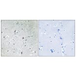 Immunohistochemistry - Anti-mTOR (phospho Ser2448) Antibody (A7156) - Antibodies.com