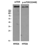 Western Blot - Anti-mTOR (phospho Ser2448) Antibody (A7156) - Antibodies.com