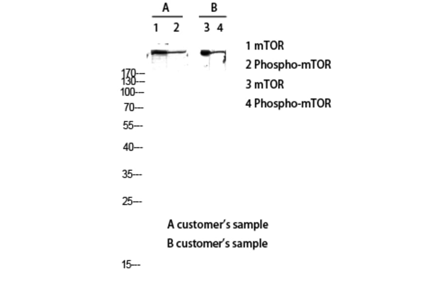 Western Blot - Anti-mTOR (phospho Ser2448) Antibody (A7156) - Antibodies.com