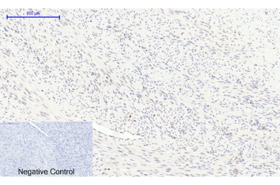 Immunohistochemistry - Anti-mTOR (phospho Ser2448) Antibody (A7156) - Antibodies.com