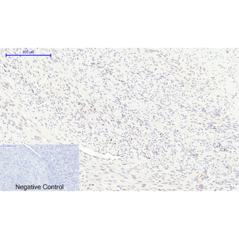 Immunohistochemistry - Anti-mTOR (phospho Ser2448) Antibody (A7156) - Antibodies.com
